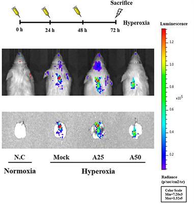 Aspirin Attenuates Hyperoxia-Induced Acute Respiratory Distress Syndrome (ARDS) by Suppressing Pulmonary Inflammation via the NF-κB Signaling Pathway